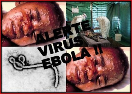 ebola