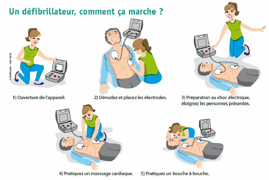 Massage cardiaque chez l'enfant, avec un défibrillateur 