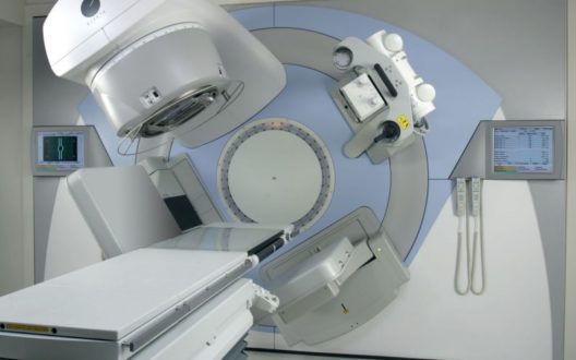 radiotherapie