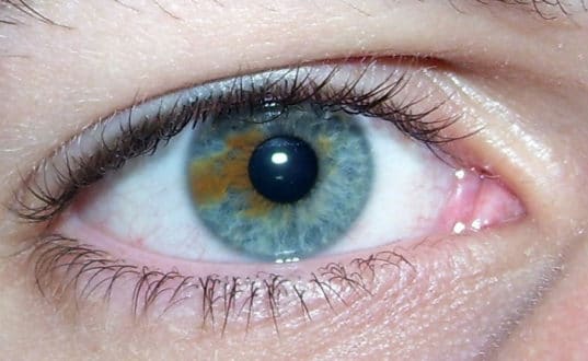 yeux_bandes